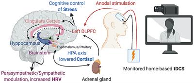 Home-Based Transcranial Direct Current Stimulation (tDCS) to Prevent and Treat Symptoms Related to Stress: A Potential Tool to Remediate the Behavioral Consequences of the COVID-19 Isolation Measures?